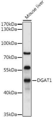 Western Blot: DGAT1 AntibodyBSA Free [NBP2-92984]